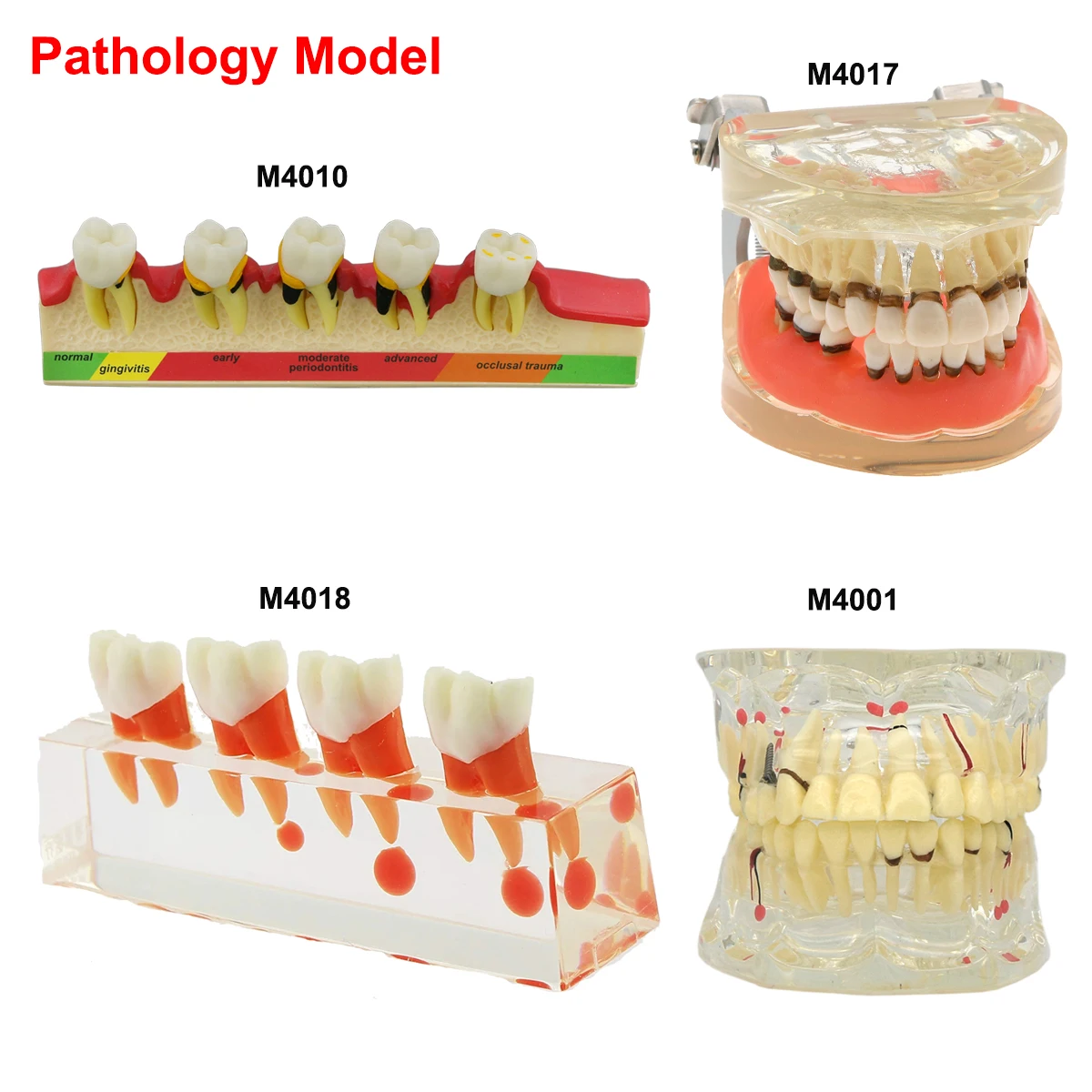 Modelos dentales de varios tipos, modelo de enseñanza Dental para entrenamiento, estudiar implante de ortodoncia, material de odontología