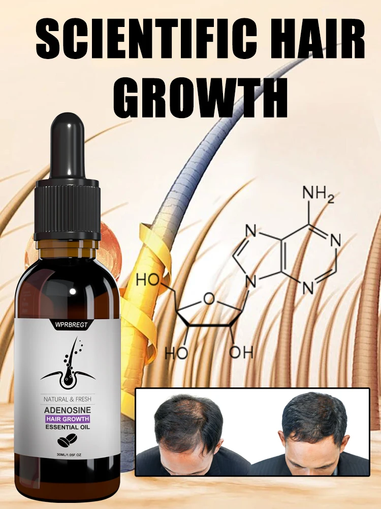 Suero para el crecimiento del cabello con adenosina esencia solución aceite productos activador tratamiento rápido para la calvicie alopecia hereditaria y seborreica