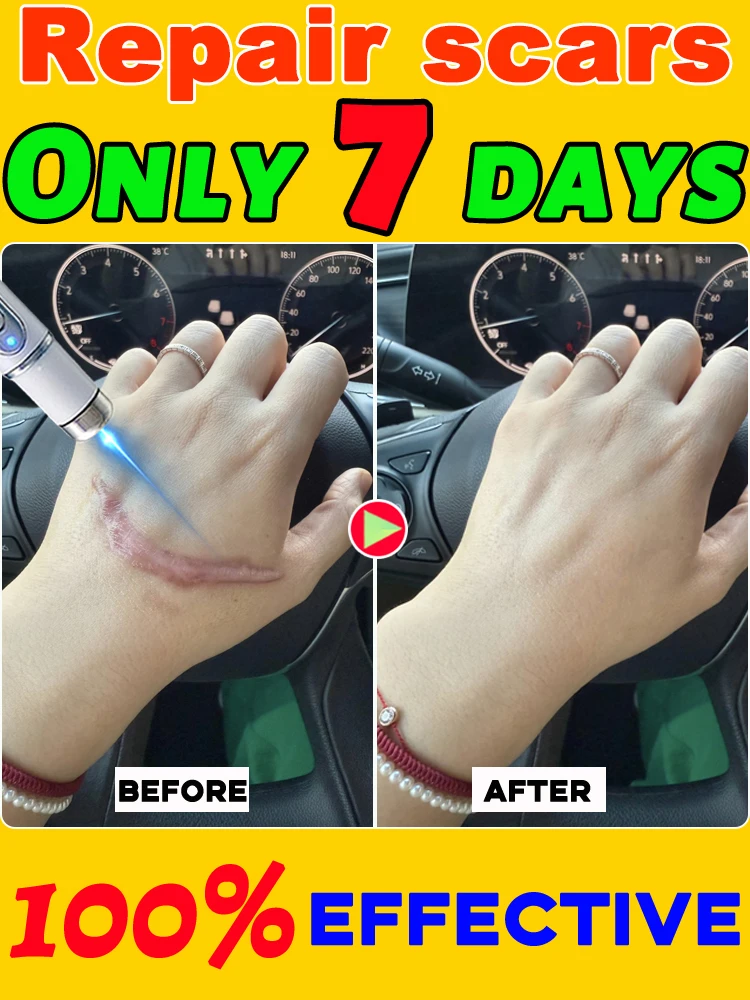 Faites les cicatrices qui disparaissent et a réchauffent votre confiance