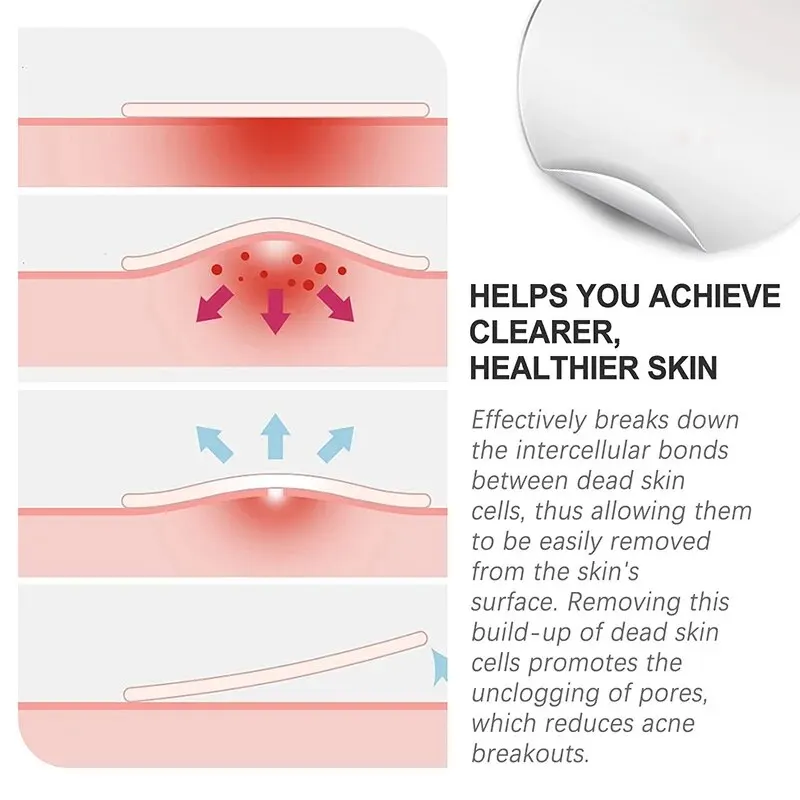 رقعة بثور كونسيلر تجميل غير مرئي ، عناية بالوجه قابلة للتنفس ، لطيفة غير مزعجة ، مسام تنقية محمولة ، شفافة