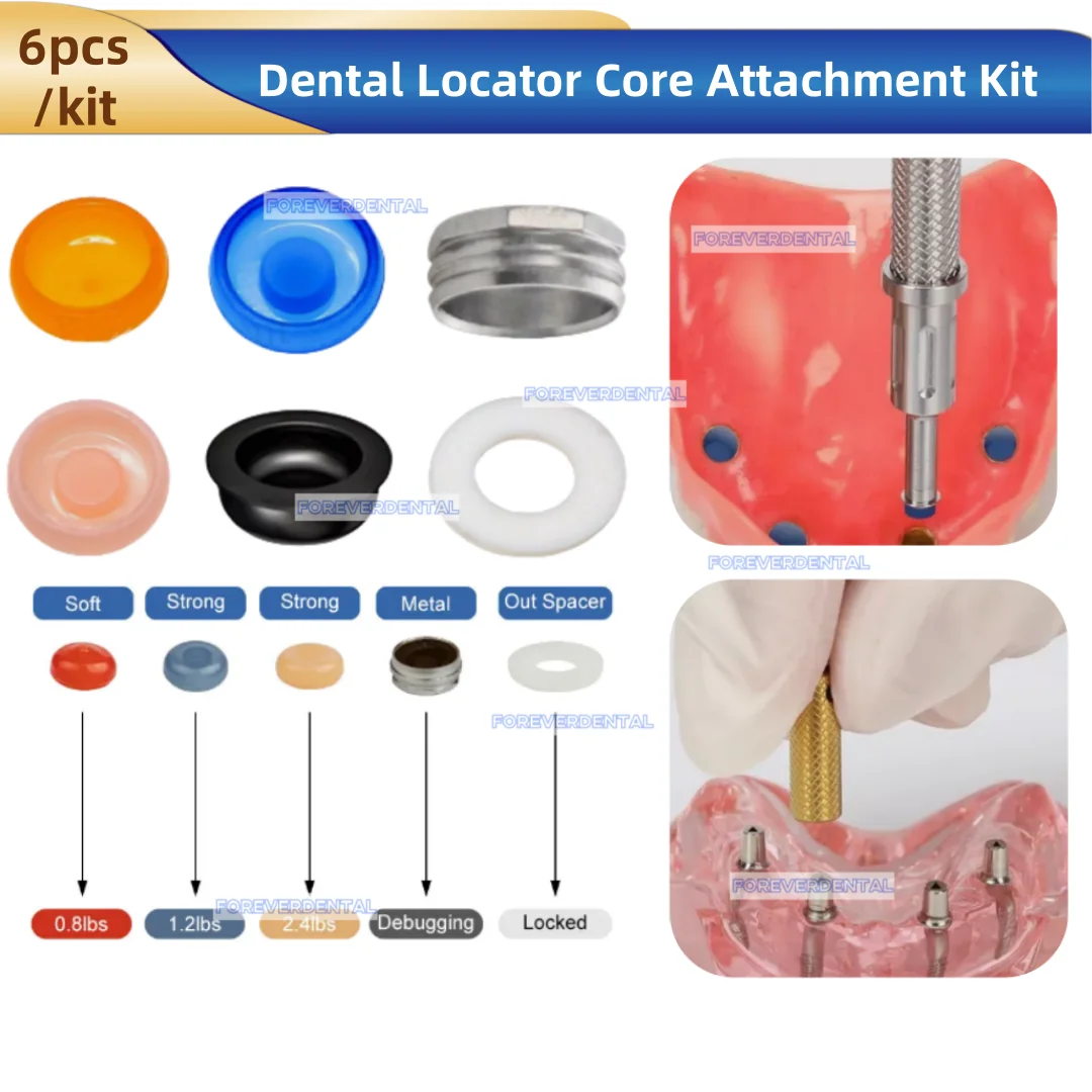 Dental Retention Caps Implant Locator Core Removable Insertion Extraction Universal Tool Overdenture Attachment 6pcs/Kit