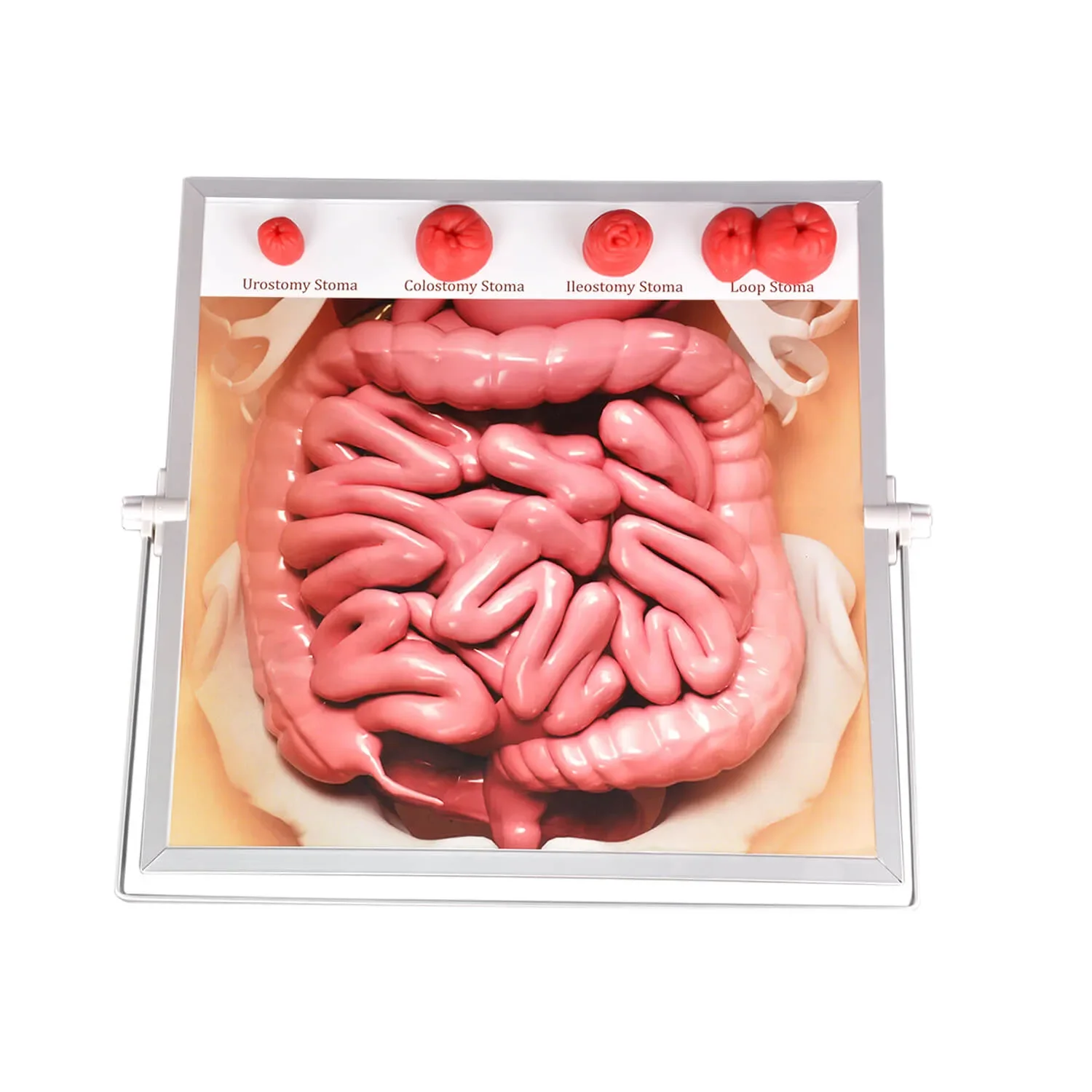 Ultrassist Ostomy Care Simulator Kit Educational Tool for Nurses Medical Students & Patient Guidance Hangable & Tabletop Design