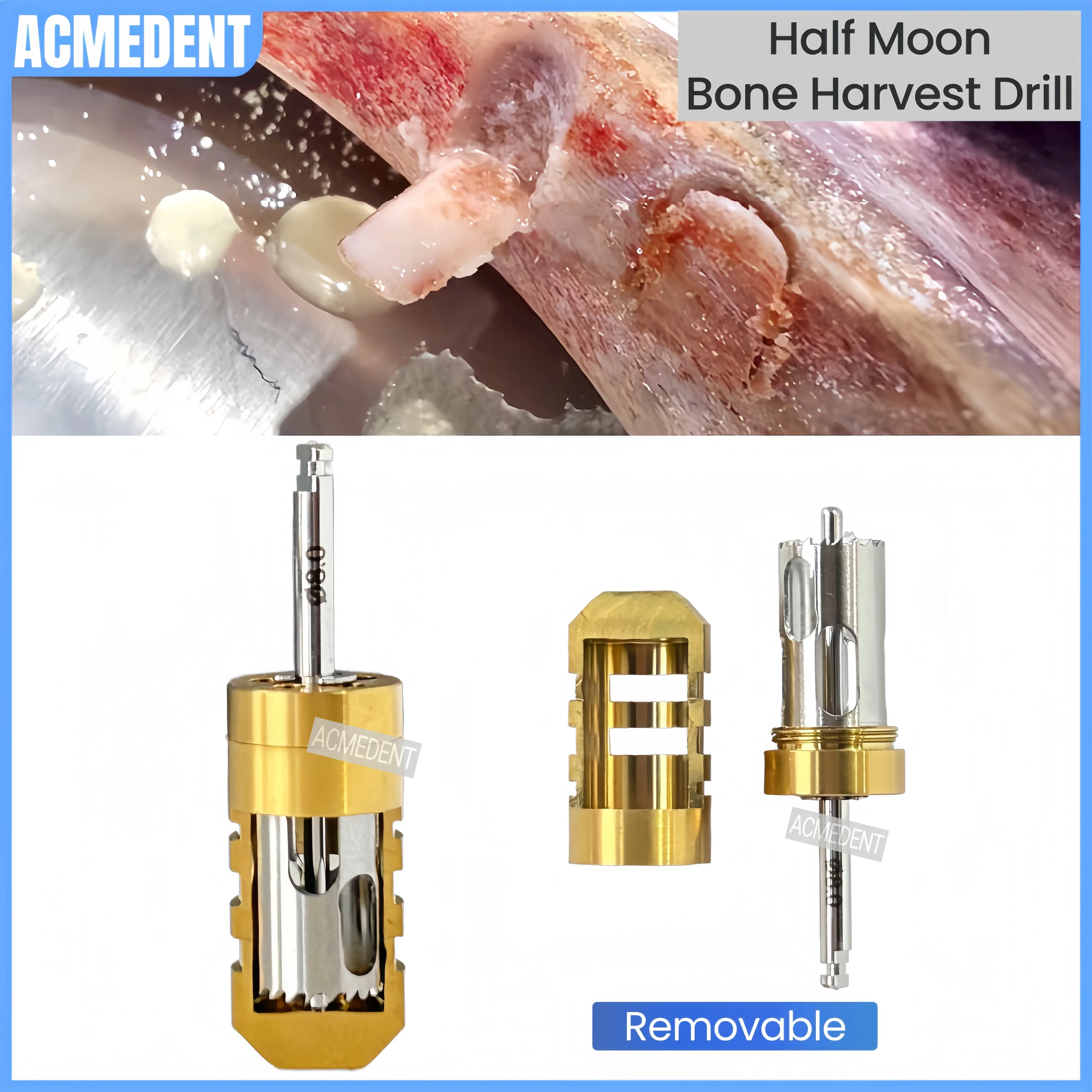 ⌀8.0 Dental SLT Half Moon Harvest Drill Semilunar Technique GBR Bone Collector Drill Autologous Bone Slice To Extract Flake