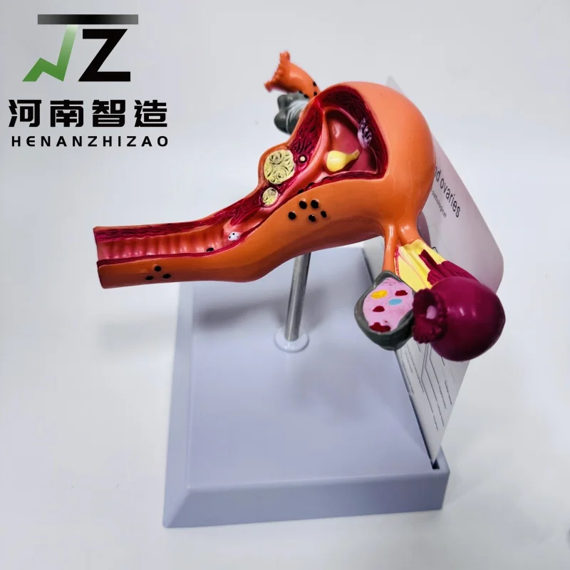 High quality female reproductive phantom model uterine model