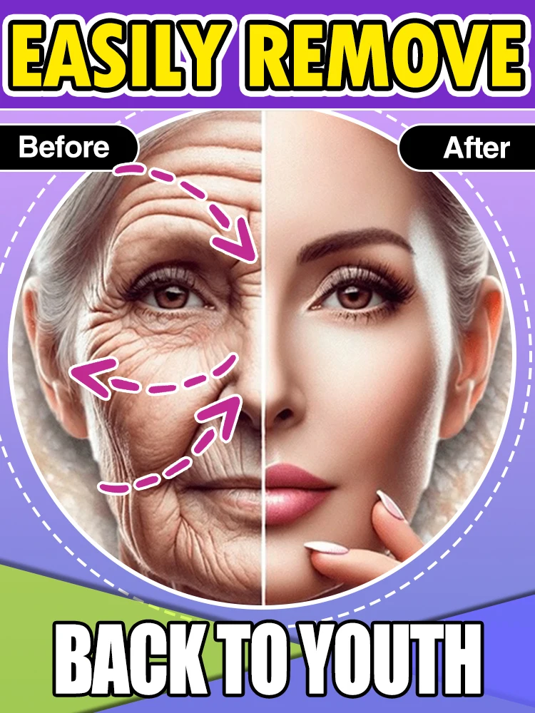 

20 years younger