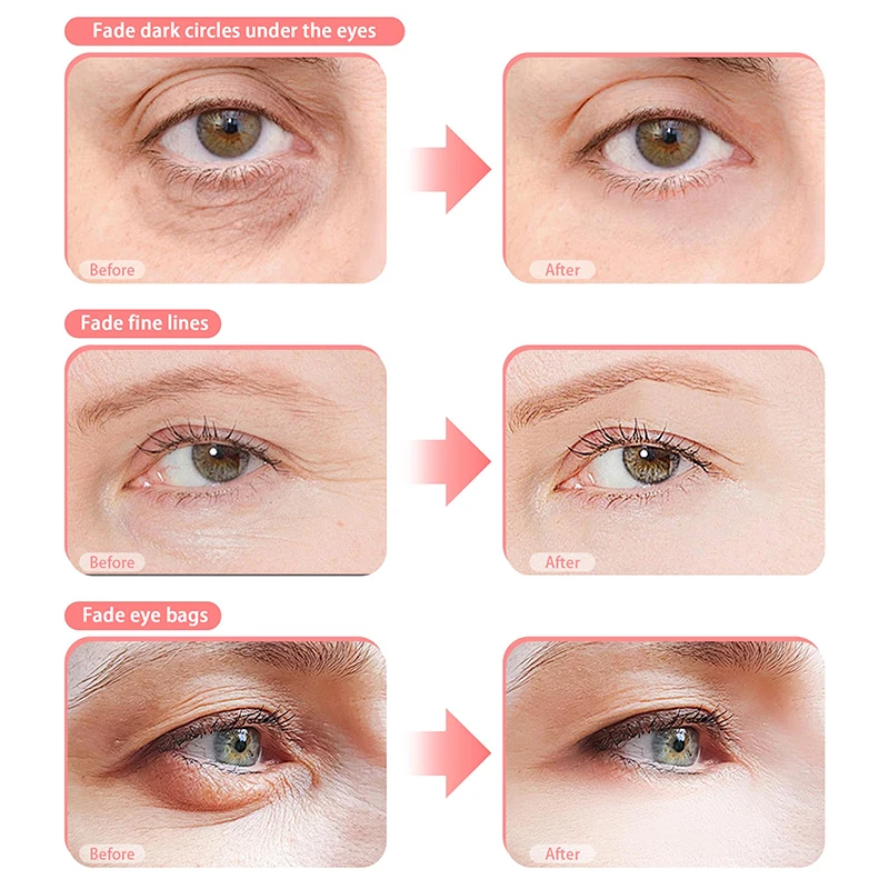 ثلاثية الأبعاد الضوء الأحمر EMS العين مدلك العناية بالعين نظارات الهالات السوداء الانتفاخ التجاعيد تقليل تعب العين الاسترخاء جهاز العناية بالجمال #4