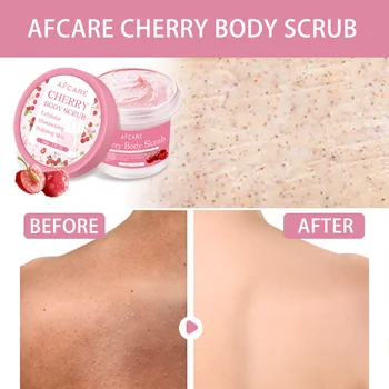 Cherry Body Scrub Exfoliator Diepe Reiniging Hydraterende Niacinamide Whitening Verbeteren Gebarsten Kippenhuid Exfoliërende Crème