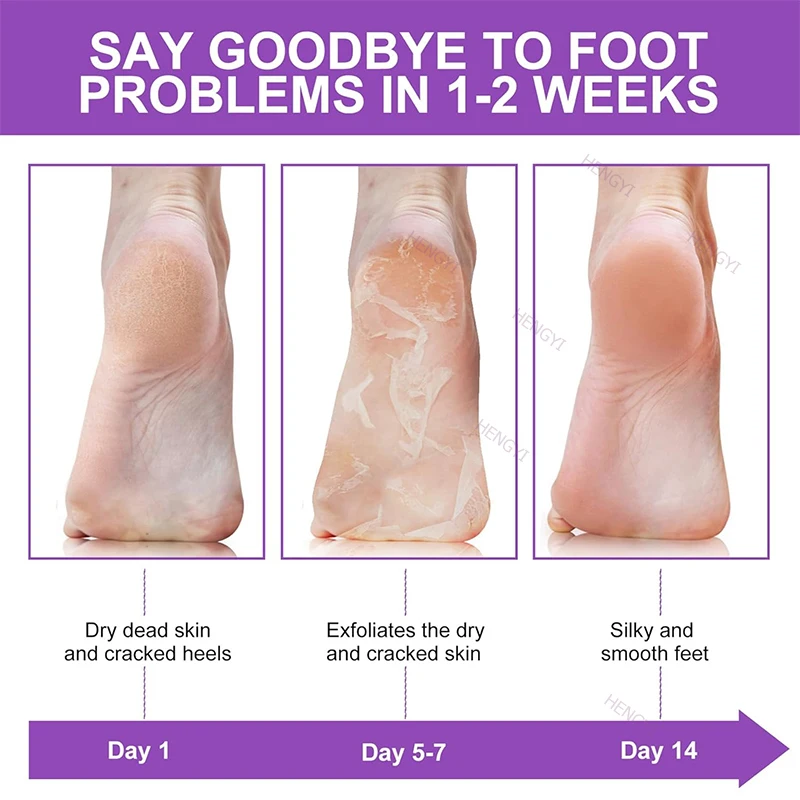 Foot Peel Mask 10 Pack Exfoliator Lavender Natural Peel Off Calluses Dead Skin Callus Remover Moisturizing Smooth For Men Women