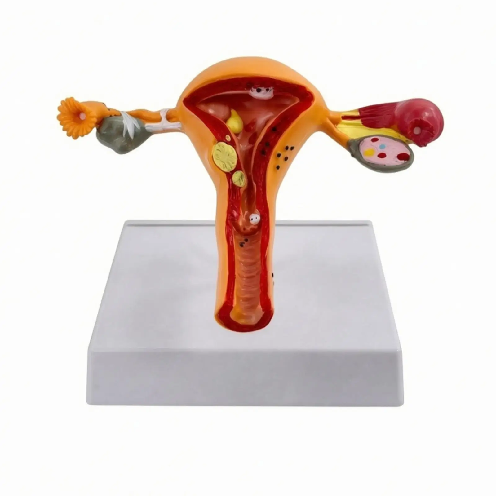 Uterus Anatomy Model Plastic Female Reproductive System Teaching Aid for Medical Training