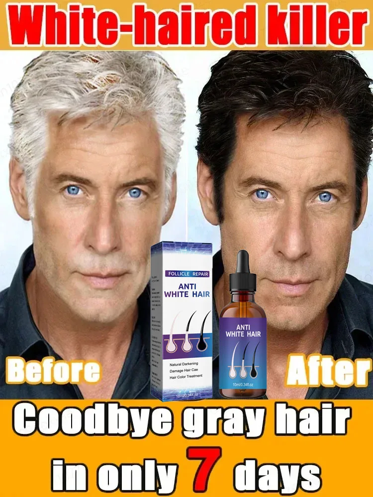 Anti-Grey Hair Essence White Turn Black Improves Texture Strengthens Roots Thicker Healthier Hair Reduces Gray Hair Health
