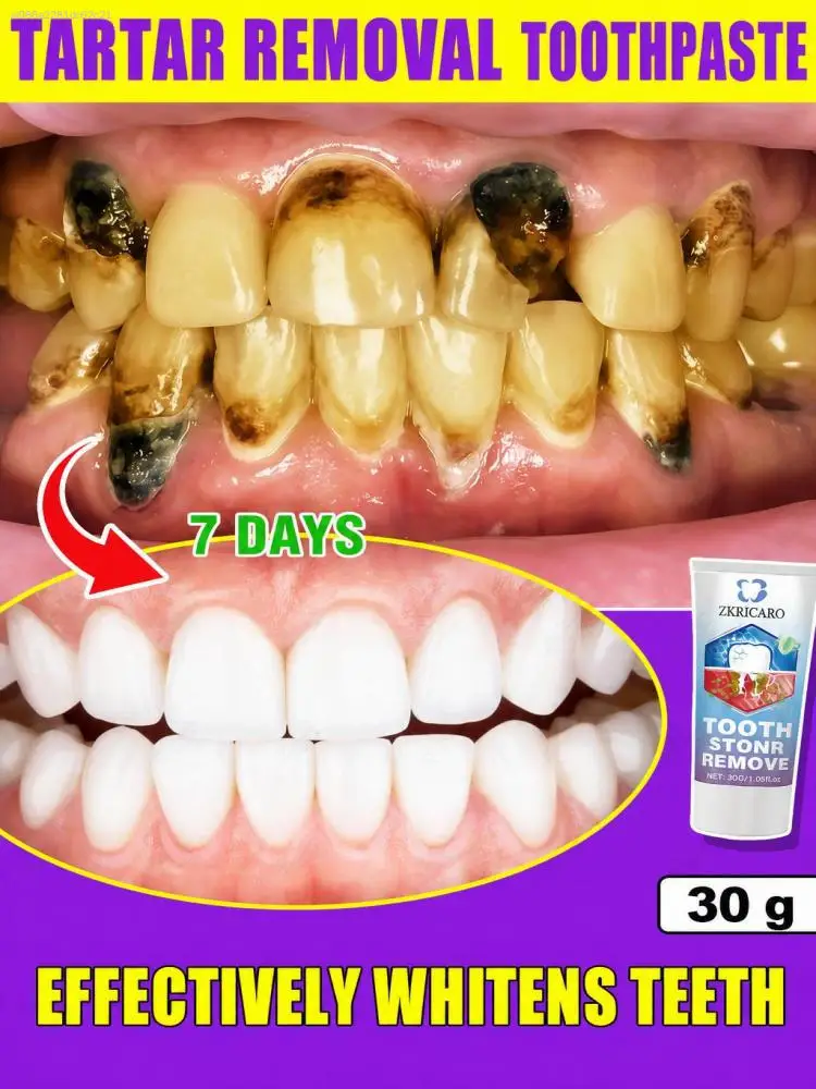 Hydroxyapatite Toothpaste Effectively Combats Tartar, Promotes Enamel Re-strengthening, Deeply Removes Plaque, Protects Gums, and Addresses Issues Such as Swollen Gums and Bad Breath. It Provides Professional Oral Hygiene, Fresh Breath, and Overall Care.