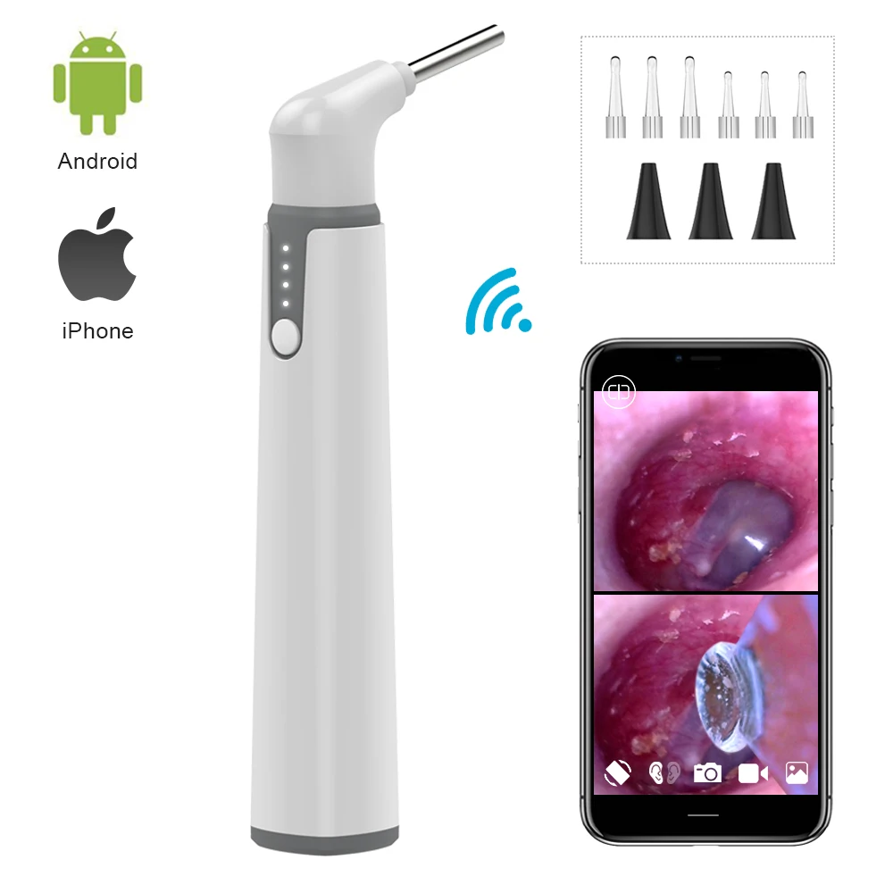 Endoscope numérique pour enfants et adultes, nettoyeur de cérumen, Wi-Fi, caméra d'inspection 2MP, Kanoscope d'oreille, Android, iPhone, Top 1PC, 2 PCs, 3.9mm