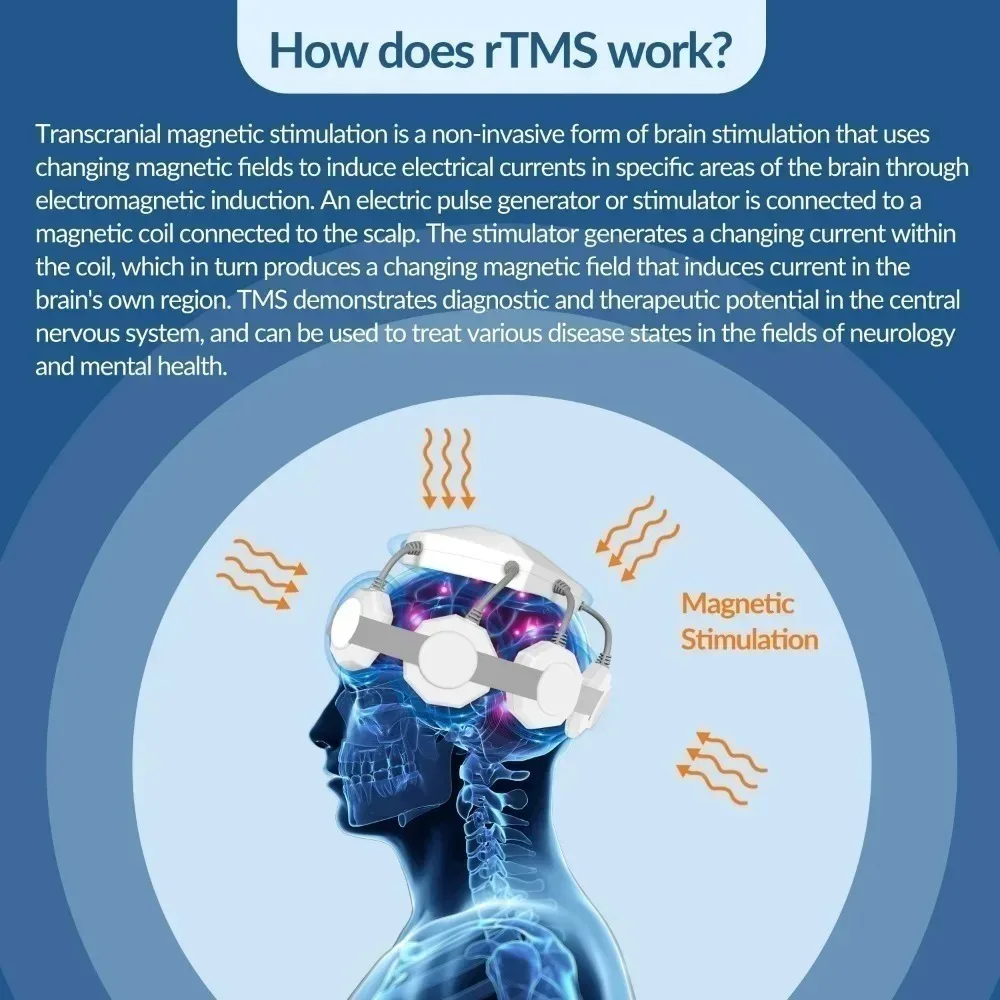 ZJZKTOP RTMS Transcranial Magnetic Stimulator 40Hz Home‑Use Brain Therapy Machine For Stress Calming Cognitive Disorders