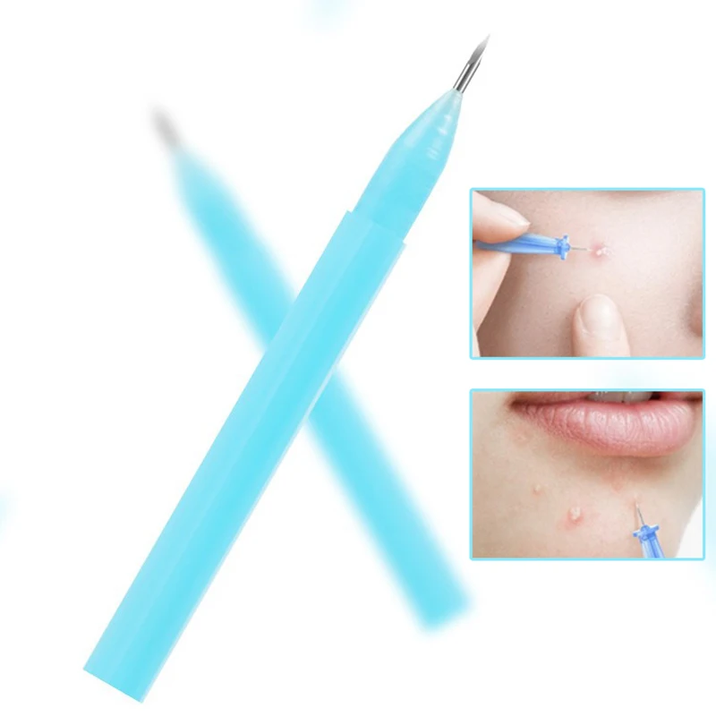 1 Beutel Einweg-Akne-Pins mit spitzer Spitze, Größe S, Mitesser- und Hautunreinheiten-Entferner, Gesichtspflege-Tools