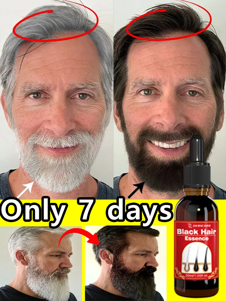 

Сыворотка для волос против седых волос для мужчин и женщин — обратные седые волосы, восстановление натурального черного блеска, 100% натуральный экстракт трав, без химика