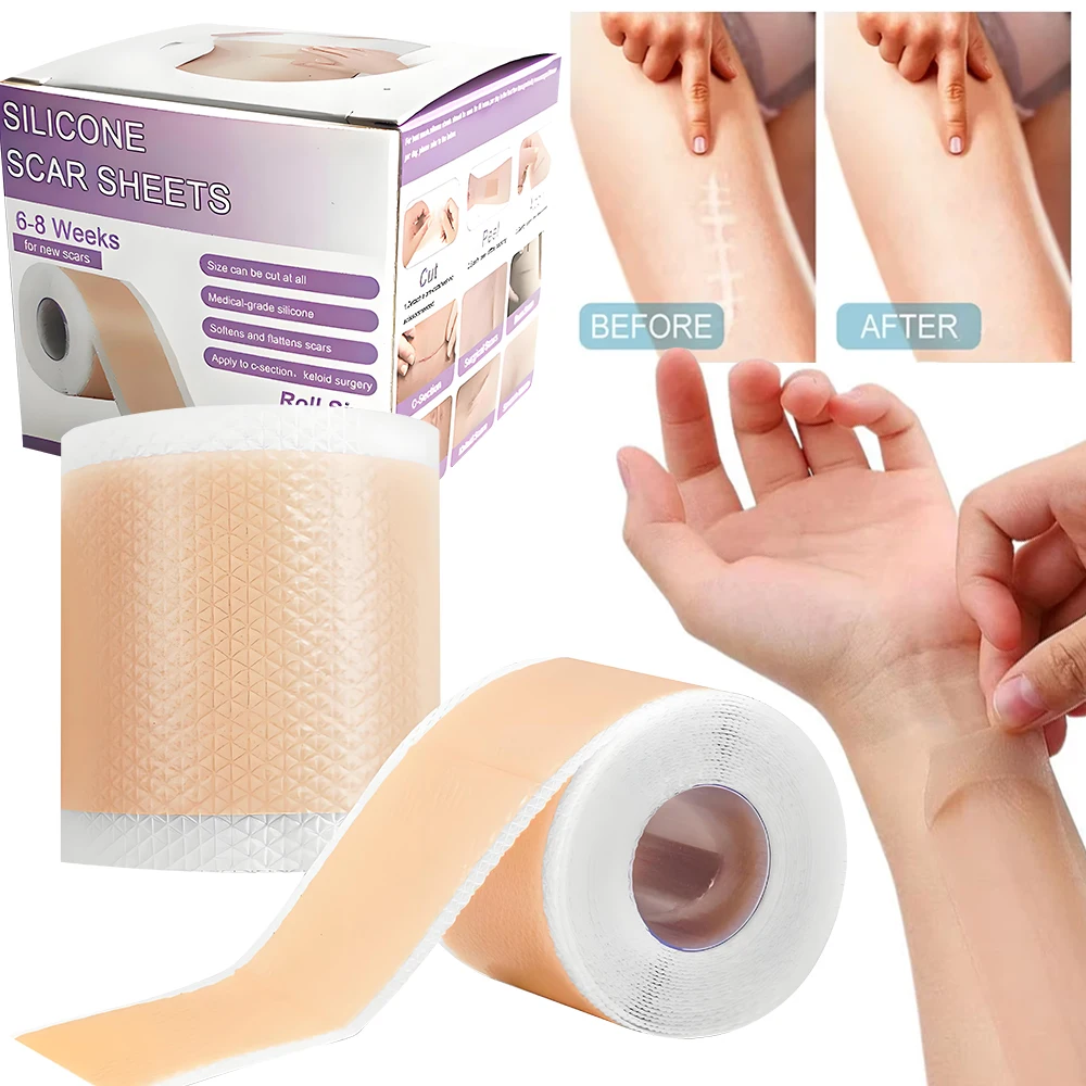 

1 Roll Silicone Scar Sheets Self-Adhesive Scar Cover Tape Reusable and Effective Skin Care Strips 1.5M/3M Silicone Scar Sheets