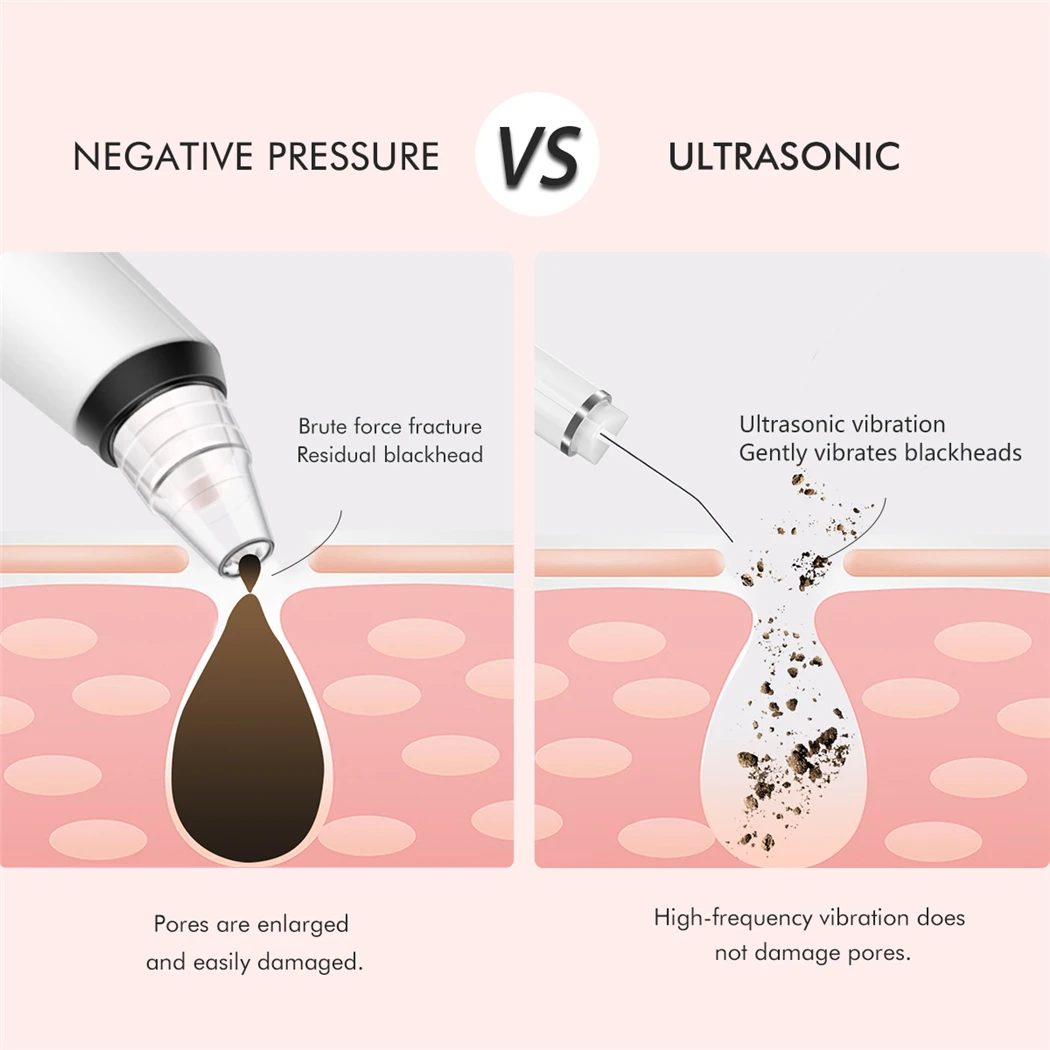 CkeyiN Scrubber ad ultrasuoni per il viso detergente profondo pala per la pelle macchina per la pulizia dei pori massaggiatori per il sollevamento del viso rimozione di punti neri