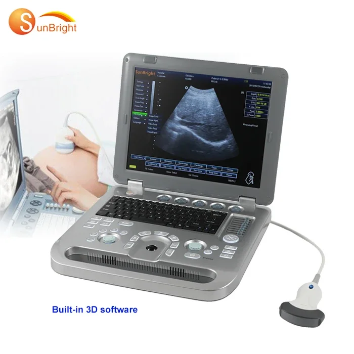 Laptop Diagnostic portable ultrasound veterinary sonar For Pregnancy