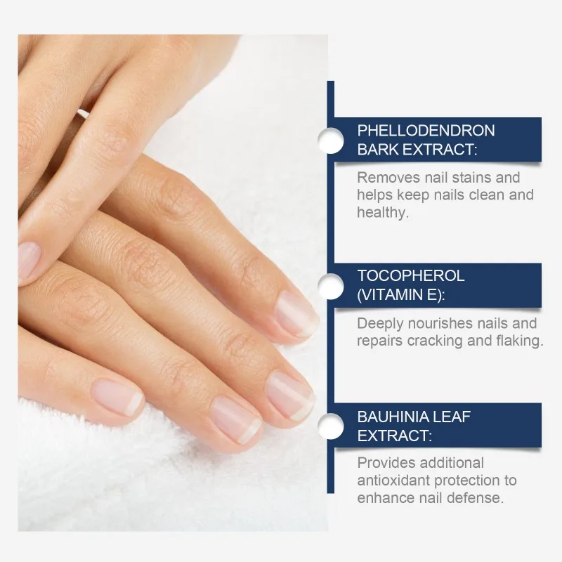 Nail Cutin Care Essence Treatment Feet Onychomycosis Repair Onychomycosis Toenail Nutrition Liquid Moisturizing Nail Health Care