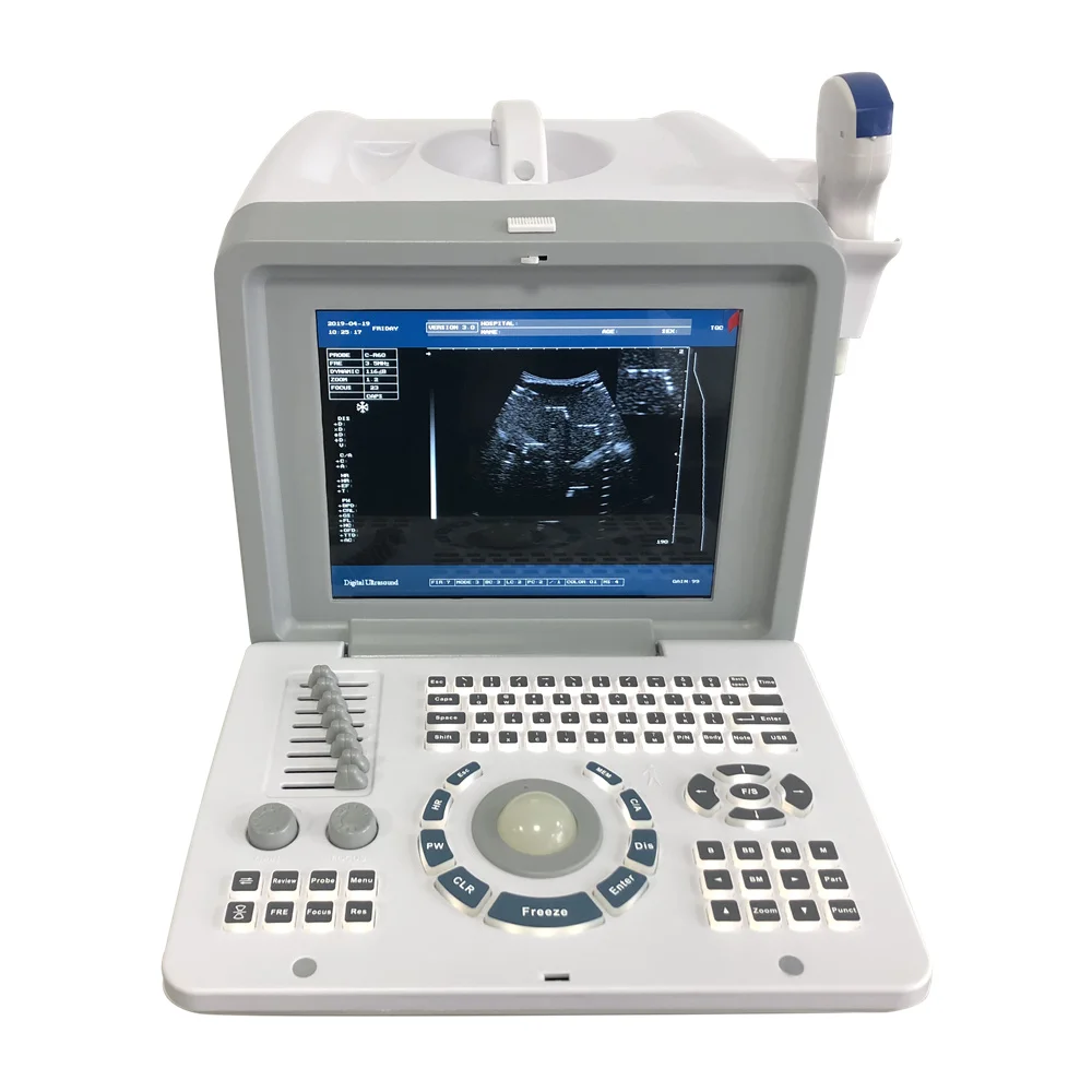 

Hospital Clinic use Cheap price B/W mode Full Digital Portable Ultrasound device with convex linear probe