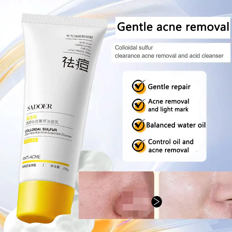

Acne-removing Facial Cleanser To Improve Facial Powder Cleansing Dirt and Oil Repair Skin Improvement Rough and Gentle Cleanser