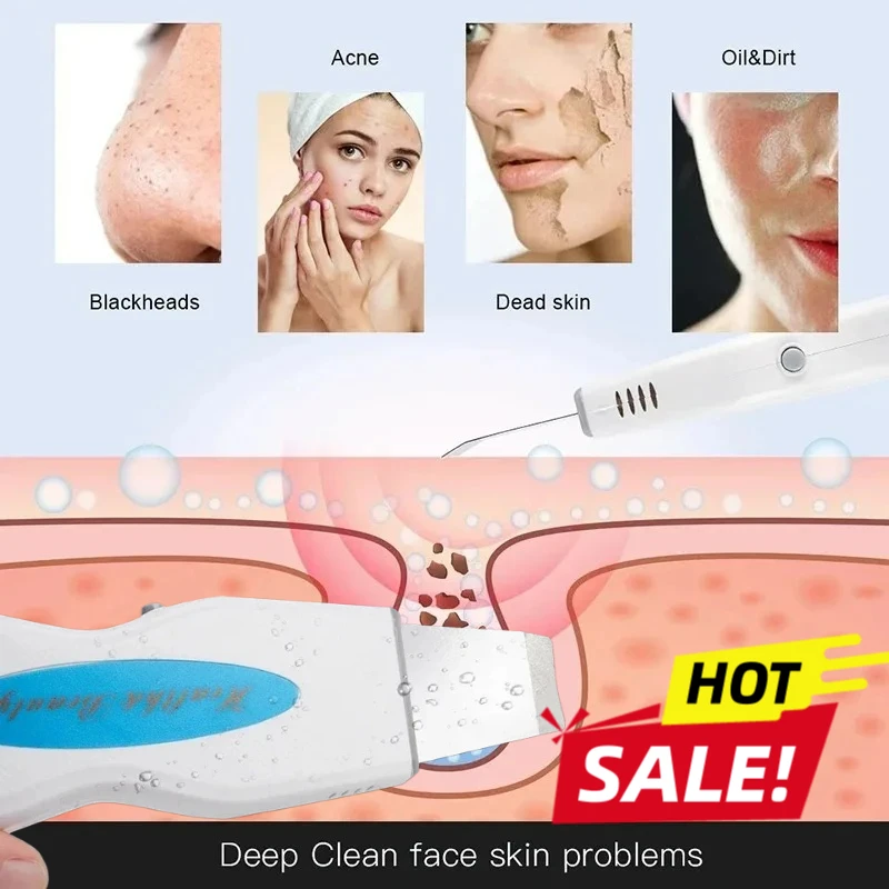 أداة تنظيف المسام بالموجات فوق الصوتية الاحترافية، أداة تنظيف ملعقة الجلد قابلة لإعادة الشحن لإزالة الرؤوس السوداء وتنظيف مسام الوجه العميق #1