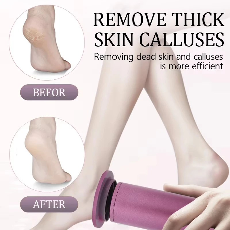 Electric Foot Callus Remover USB Wired Adjustable Speed Pedicure Tool Professional Dead Skin Eraser for Home Foot Care - view 5
