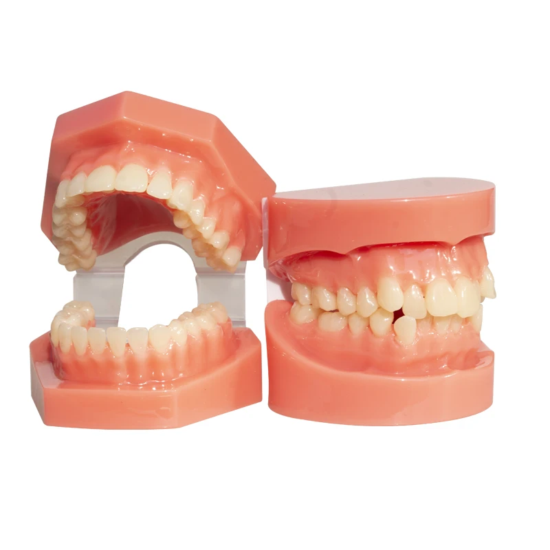 Dental Malocclusion/Standard Demonstration Correction Model Dentist Practicing Adhesive Bracket Model Correction Teaching Mold