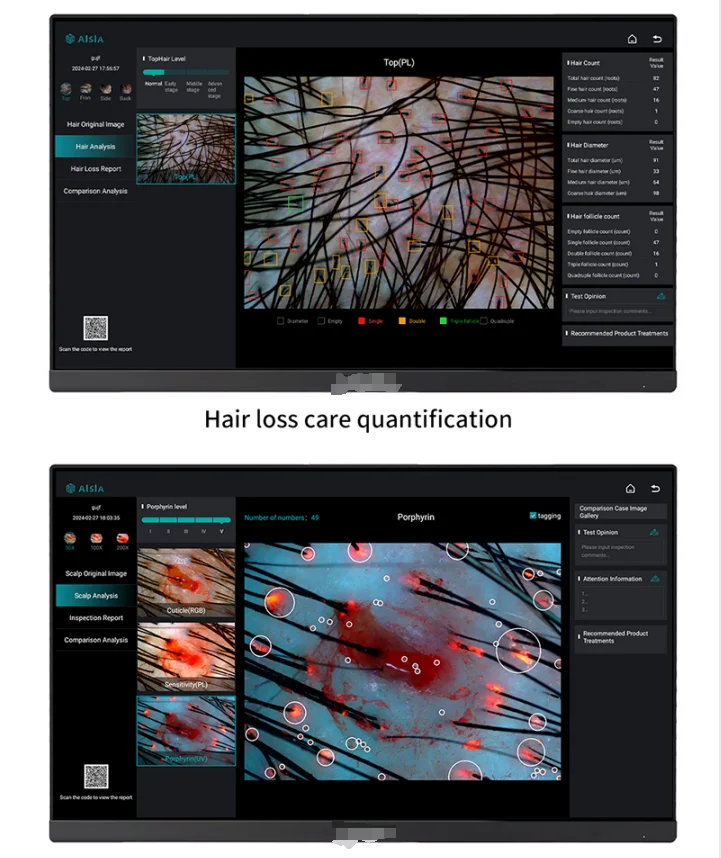 2025 جديد المهنية آلة العناية بالشعر كاشف بصيلات الشعر آلة العناية بالشعر الجلد فروة الرأس معدات محلل الشعر #1