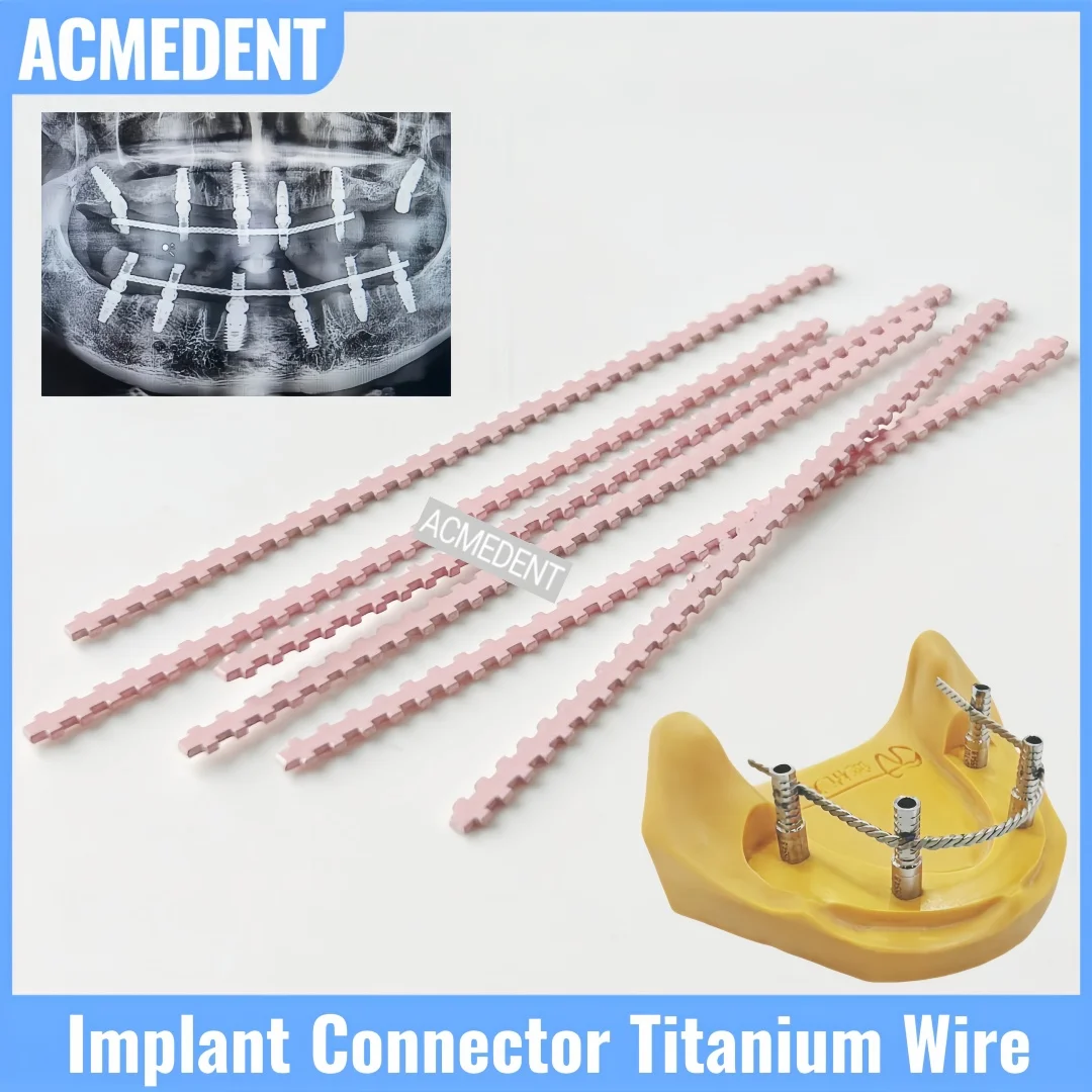 

5-100Pcs Dental Implant Pink Color Connector Tianium Wire Strengthener Twist Wires Strengthening Wire Retained Overdentures MU