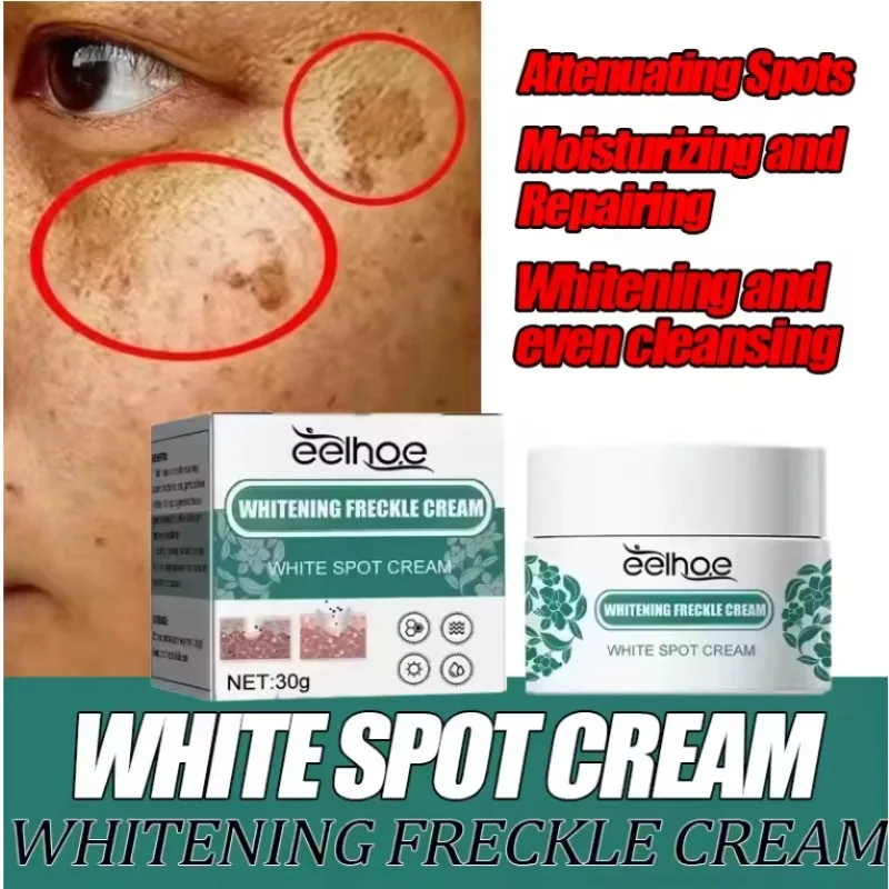 

Removal Dark Spots Whitening Freckle Cream Leaving skin looking brighter clearer and more luminous prevent future discoloration