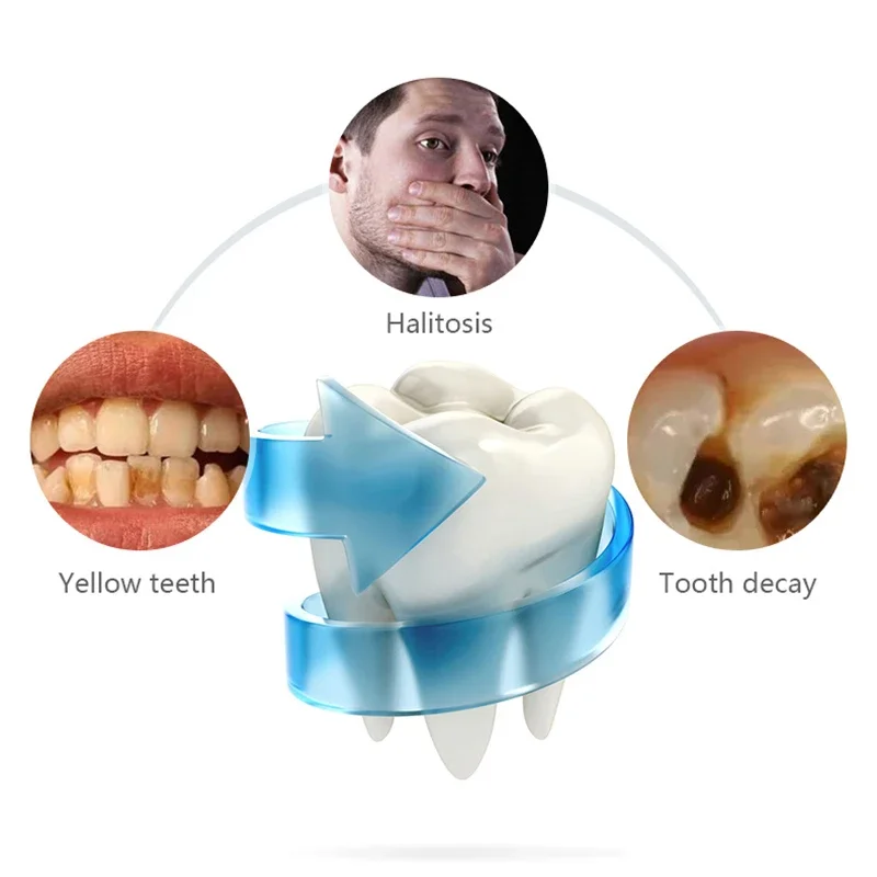 음파 충격 회전 깨끗한 전동 칫솔 - 방수, 고속 충전, 스마트 타이머 - 휴대용 및 조용함