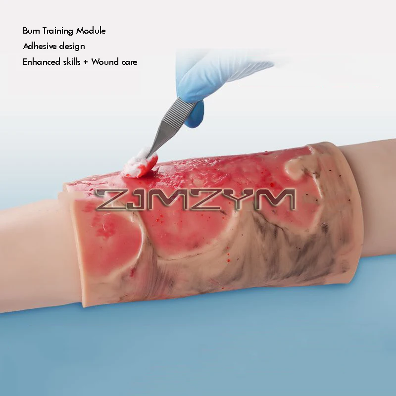 Wearable 2-3 Degree Limb Burns Training Module High Simulation Limb Burn Model Medical Student Nurse Training Model
