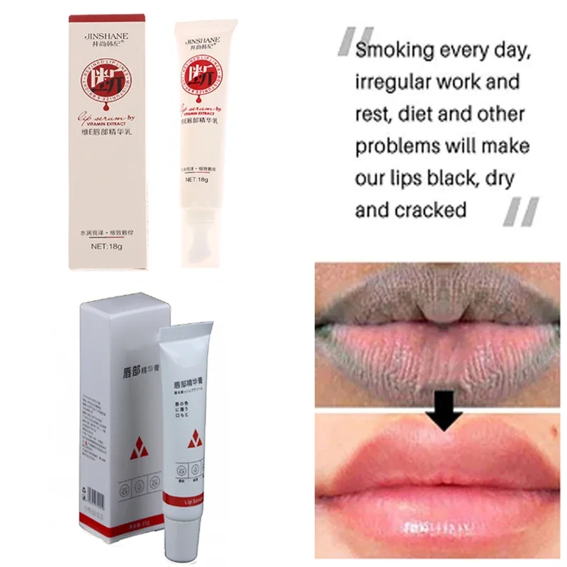 1PC Lips Pink Fresh Lightening BleachingCream Treatment Remove Dark Smoke Lips Lip Balm Whitening Moisturizer Nourishing Essence