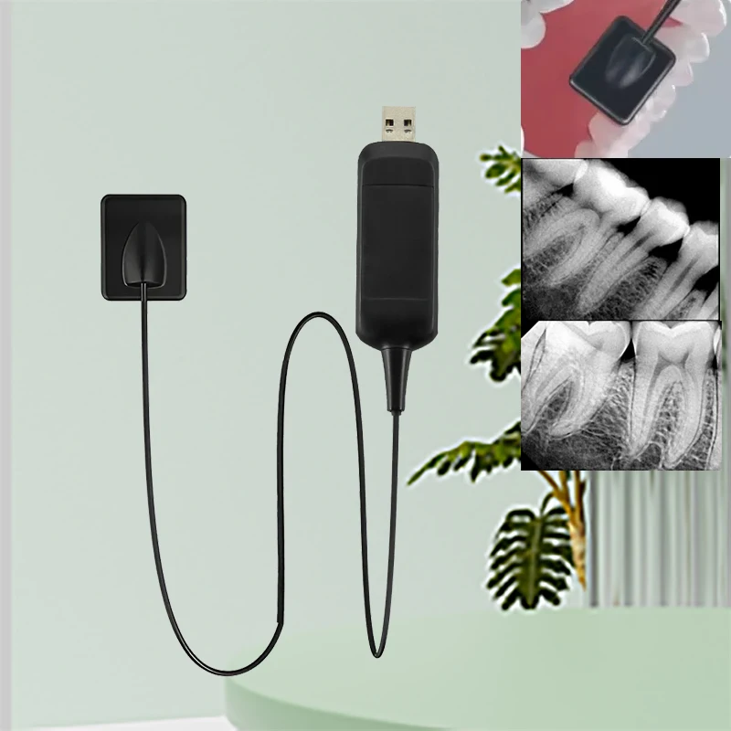 

Dental Sensor X-Ray Dentistry High-Frequency Rx Digital Intraoral Digital System H D Image Radiovisografo Dental Digital Sensor