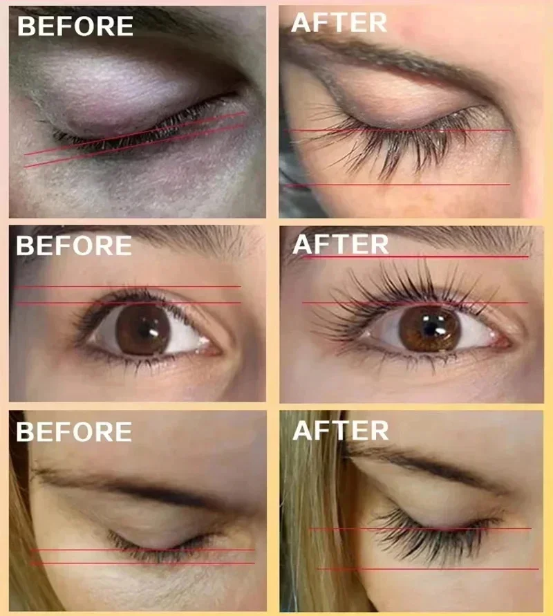 Soro de crescimento rápido de cílios, 5 dias, intensificador de cílios naturais, tratamento de cílios mais grossos, novos produtos, cuidados com os olhos, maquiagem