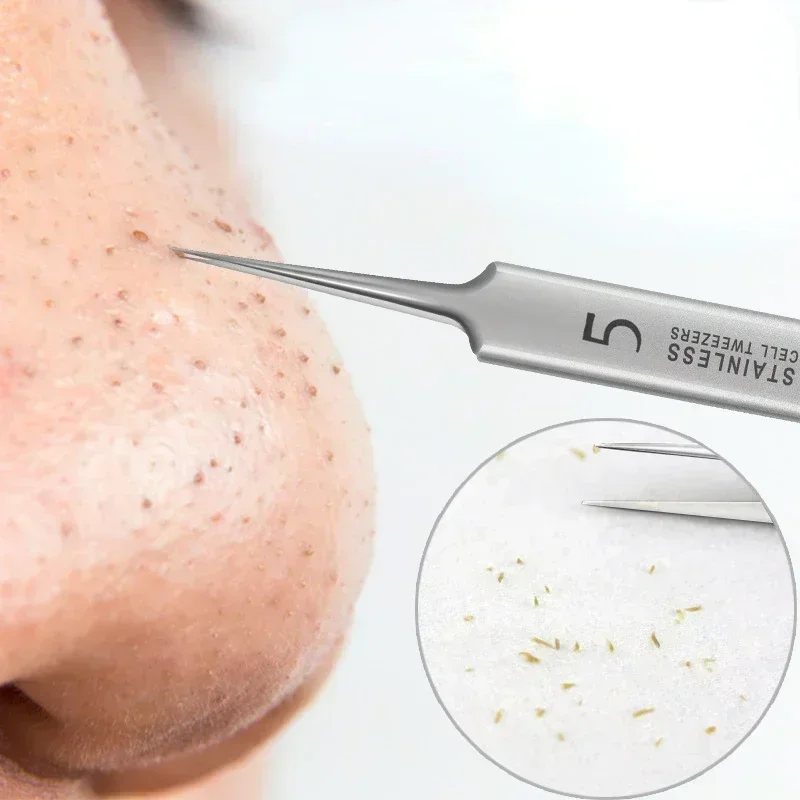 

NO-1 No. 5 Cell Pimples Blackhead Clip Tweezers Beauty Face Health Salon Special Blackhead Remover Acne Needle Tool