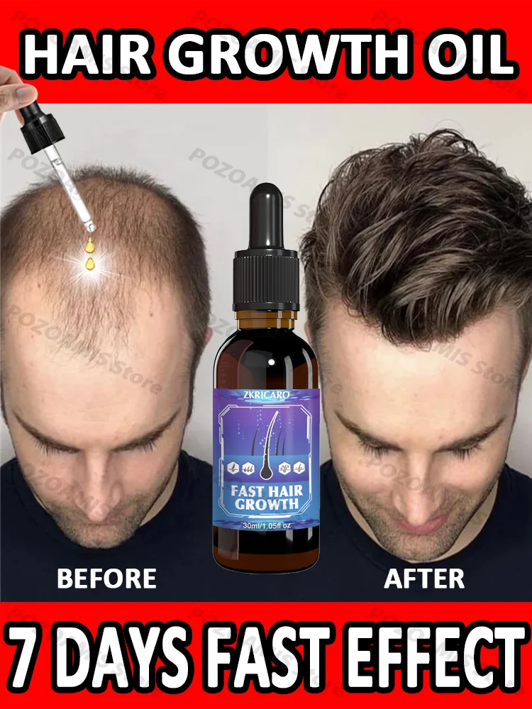 99% repurchase, more and more hair, say goodbye to baldness, hot selling product