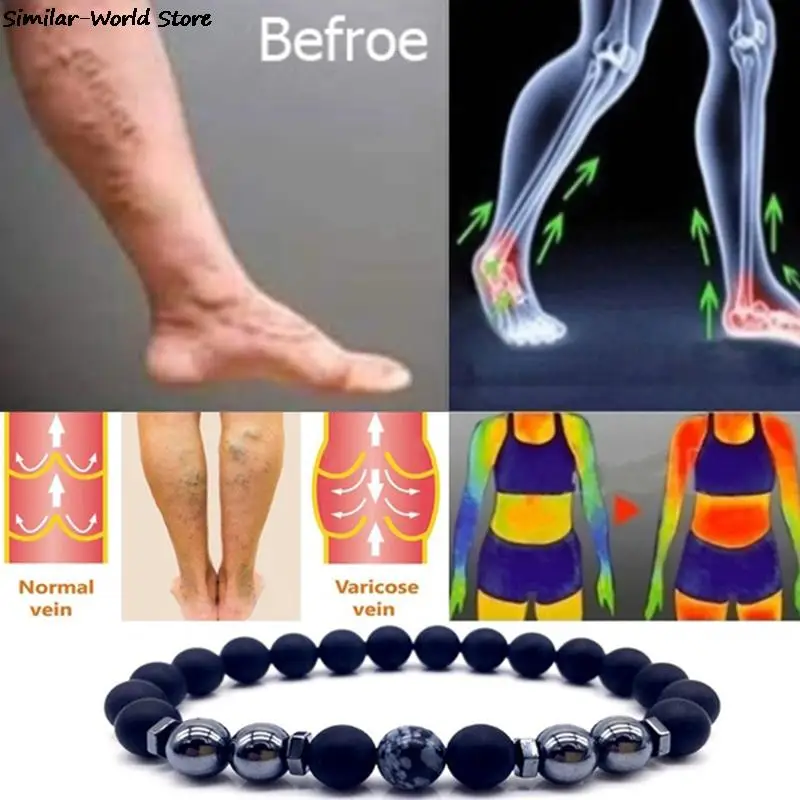 Unisex Magnet Anklet Colorful Stone Magnetic Therapy Bracelet Product Health Care Jewelry