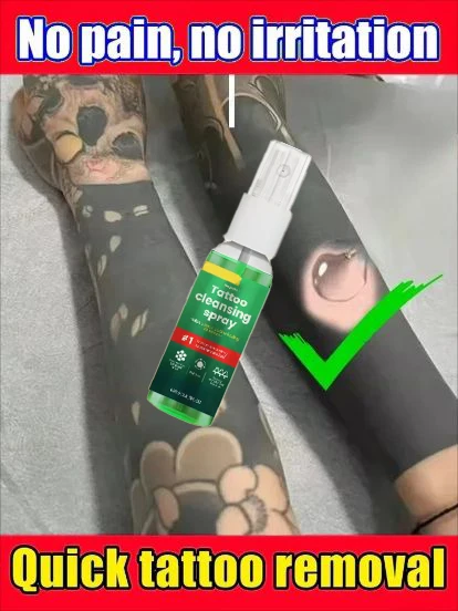

Tattoo Removal Cream, Suitable for Large and Small Tattoos, Effective in Removing Permanent Tattoos