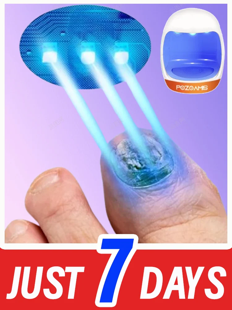 Professional nail fungus care: deep penetration of the nail plate to target and eliminate stubborn fungi.
