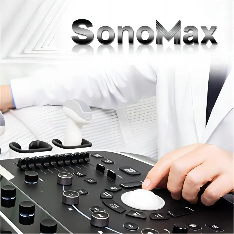 Cart-based Ultrasound Machine CHISON SonoMax 7 Stationary Ultrasound Scanner Precision Diagnostics for Healthcare Providers
