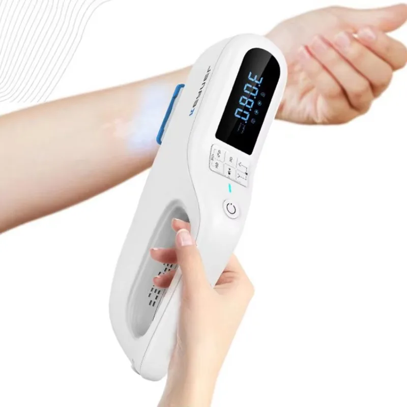 Good Effective Excimer  Phototherpay System Kernel Kn-5000e 308 Excimer r Targeted Treatment Of Psoriasis Vitiligo