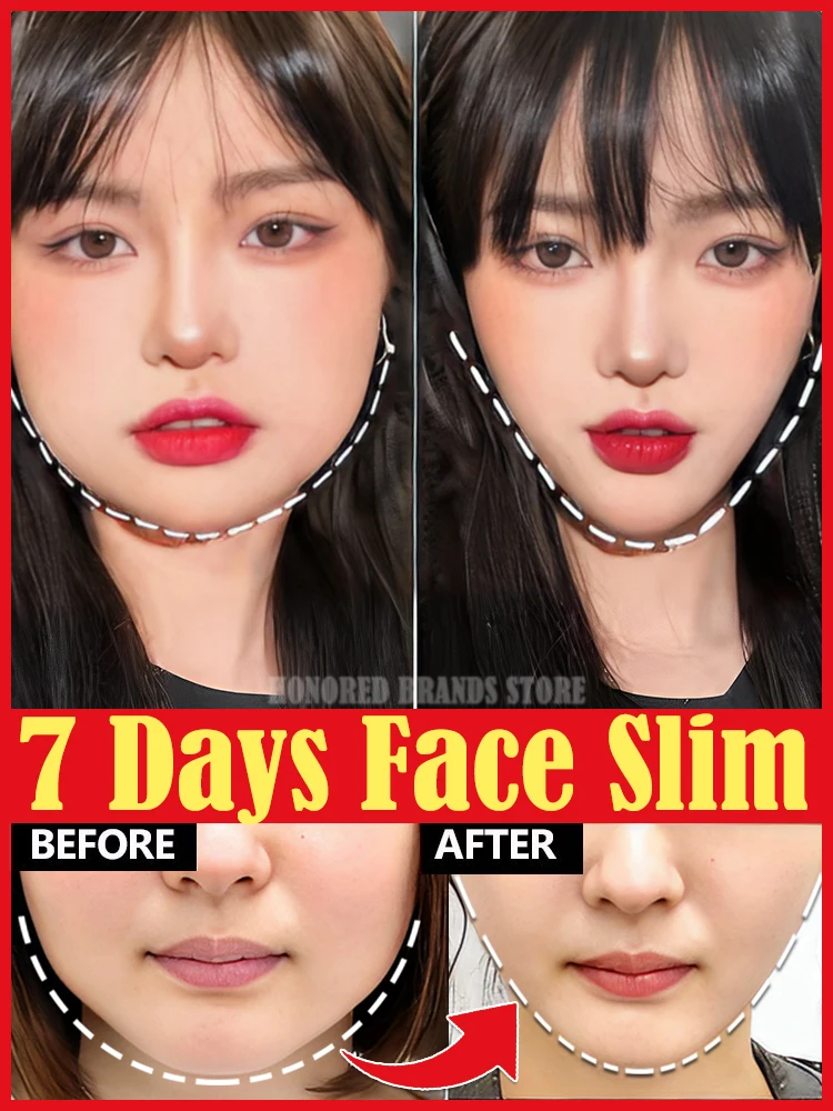 

V face cream double chin elimination V line