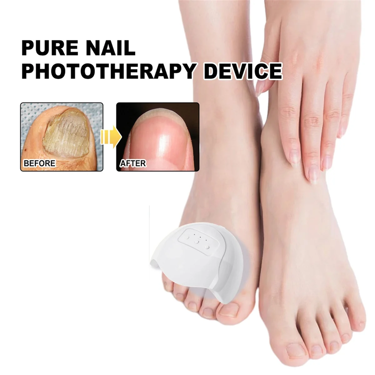 【SURPRISE】Fungal For Nail Treatment Device Lasers For Nail Fungus Onychomycosis Cleaning Foot Repair Fungi Removal Anti Mushroom