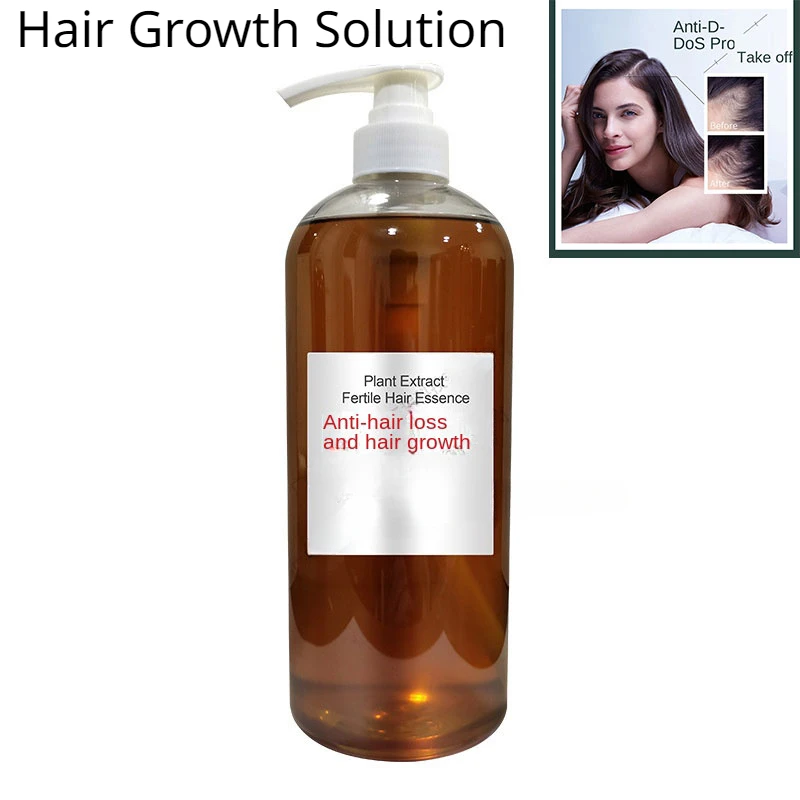 Haarwuchs öl zur Verlust behandlung Derma roller Männer Shampoo Toppik Fasern Bart Kerastase Bio Parfüm Olive Original Frauen pflege