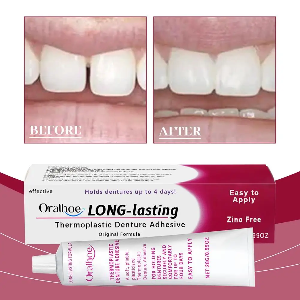 28g Seamless Fit Thermoplastic Denture Adhesive Comfortable Oral Health Care Long Lasting Reusable Denture Care 2025 NEW