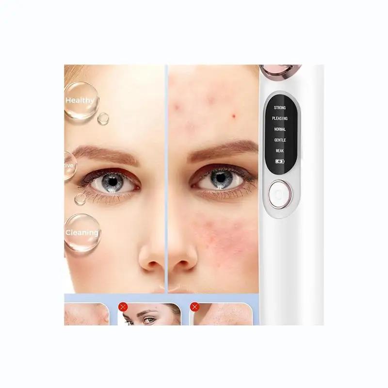 -A65I Limpiador de poros faciales Removedor de espinillas para pieles sensibles con kit de acero inoxidable de 4 cabezales extraíbles