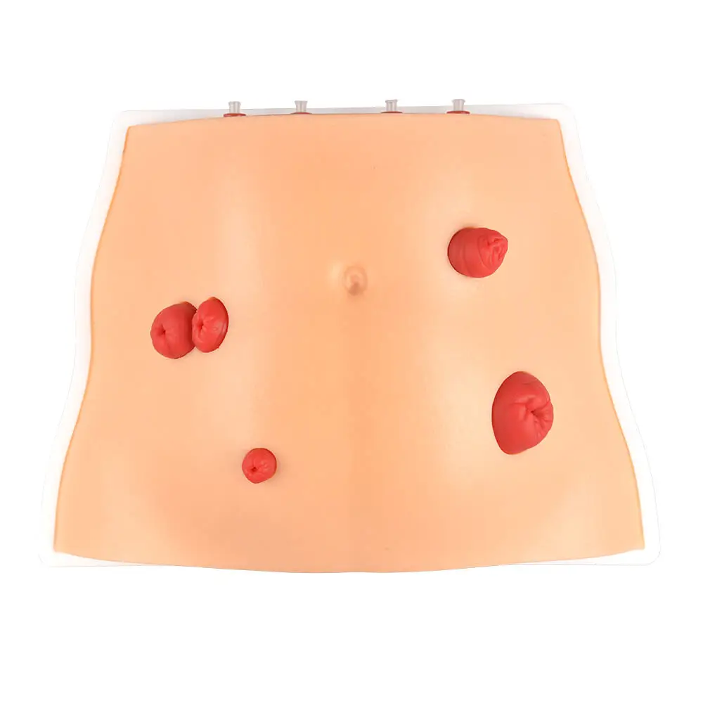 Ultrassist Abdominal Ostomy Care Model with 4 Stoma Types & Display Bracket Medical Simulation for Nursing Students Care Train