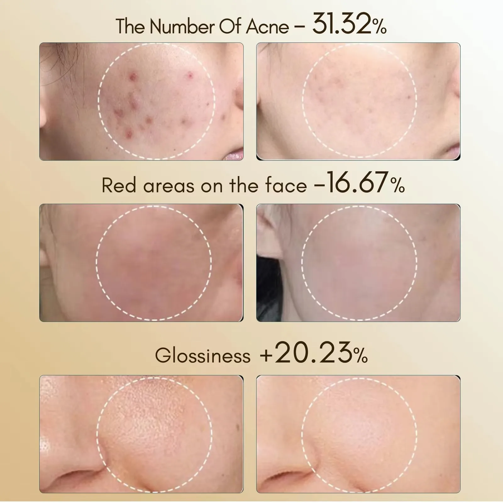 7-kleuren LED Foton Schoonheidsmasker Instrument USB Elektronisch Masker Verjonging Verlicht fijne lijntjes Fleuren Huidskleur Reparatie Huid